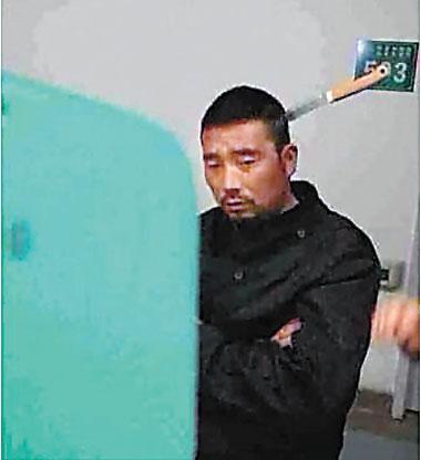 淡定哥脑袋上插水果刀 自己到医院就诊-国内