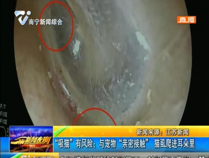 南京:“吸貓”有風險 與寵物“親密接觸” 貓虱爬進耳朵里 南京:“吸貓”有風險 與寵物“親密接觸” 貓虱爬進耳朵里