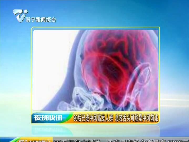 90后已成中风高发人群 总咬舌头可能是中风前兆 90后已成中风高发人群 总咬舌头可能是中风前兆