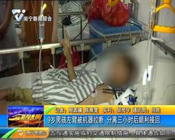 九歲男孩左臂被機器絞斷 分離三小時后順利接回 九歲男孩左臂被機器絞斷 分離三小時后順利接回