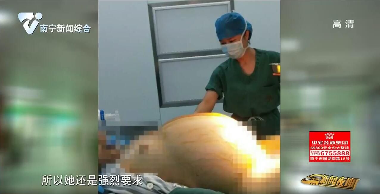 贵港:19岁女孩“身怀六甲” 医生妙手拆“定时炸弹” 贵港:19岁女孩“身怀六甲” 医生妙手拆“定时炸弹”