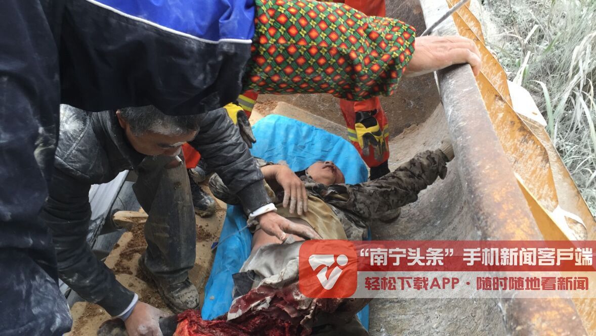 吓人!采石场工人下半身卷入碎石机 右腿膝盖被割断