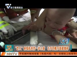 惠州：“吃人”碎纸机夹伤一岁小孩  右手四根手指被搅碎