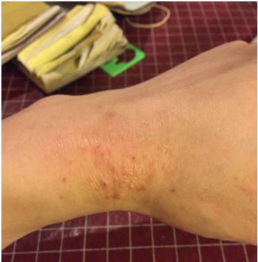 求助：艾滋病感染者想治疗