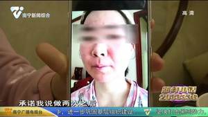 做皮肤美容没有改善 希望能退款赔偿