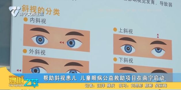 帮助斜视患儿 儿童眼病公益救助项目在南宁启动