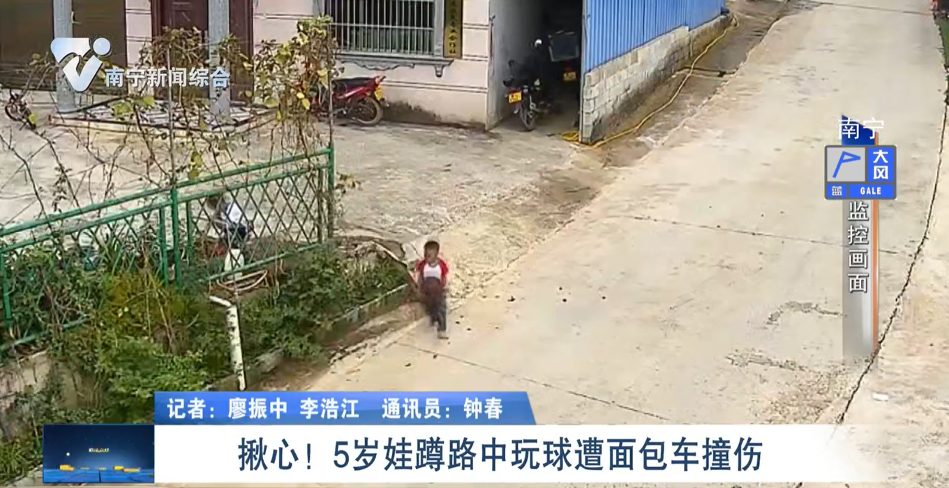 揪心！ 5歲娃蹲路中玩球遭面包車撞傷 