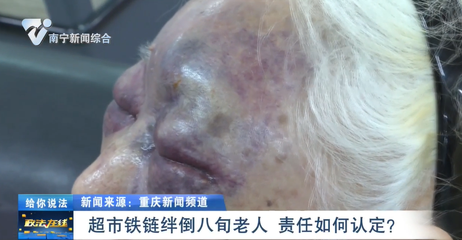 給你說法：超市鐵鏈絆倒八旬老人 責任如何認定？