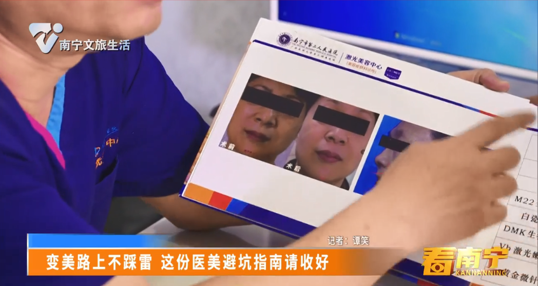 变美路上不踩雷 这份医美避坑指南请收好